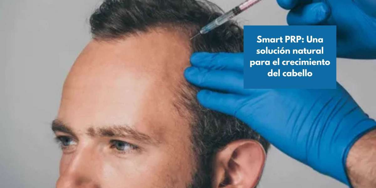Smart PRP: Una solución natural para el crecimiento del cabello