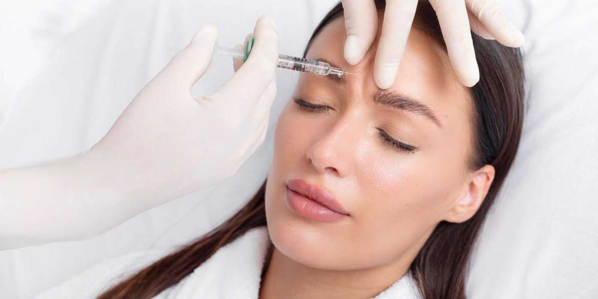 Botox in London: How It Smooths Fine Lines and Wrinkles