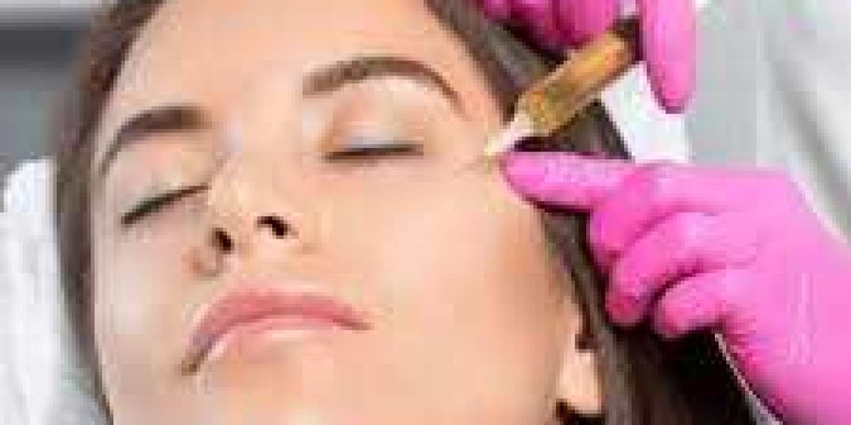 PRF in Dubai – Powerful Regenerative Treatment for Rejuvenation